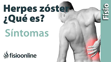 ¿Cómo se siente el dolor muscular del herpes zóster?