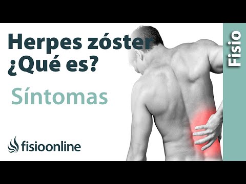 Video: ¿Puede el simplex causar culebrilla?