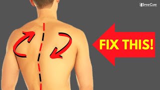 How to Fix a Twisted Back