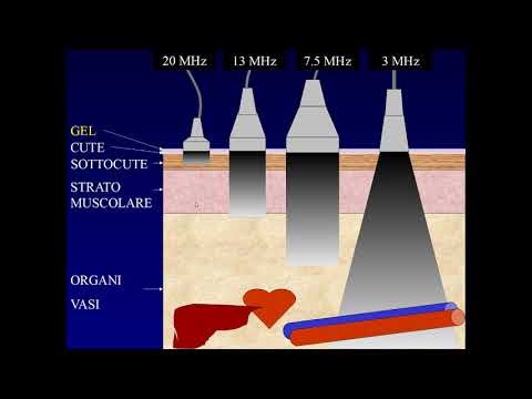 Principi fisici degli ultrasuoni - Parte 1