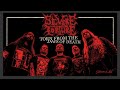 Severe torture  torn from the jaws of death official music 2024