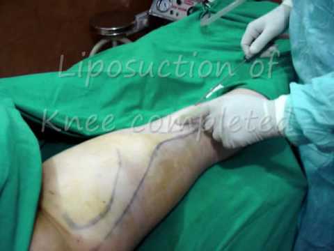 Dr. JB Ratti VITAL CLINIC New Delhi India Cosmetic...