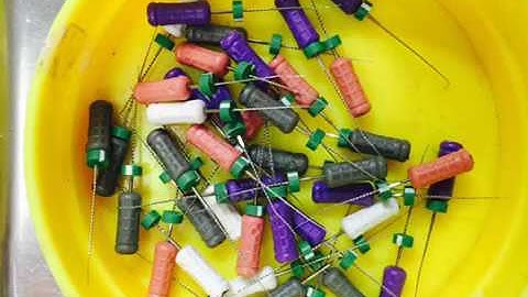 Three rooted mandibular third molar : a rare case