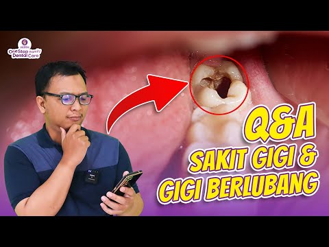 Video: Apakah gigi berlubang akan terasa sakit?