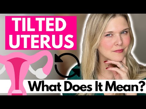 TILTED UTERUS: What