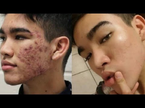 look-what-baking-soda-and-honey-can-do-to-your-face.