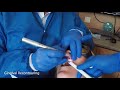 Nv pro3 microlaser  how to use  denmat dental education