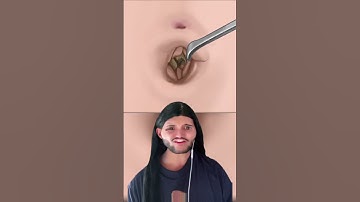 Baixaria #thiguees #explorar #reagindo #meme