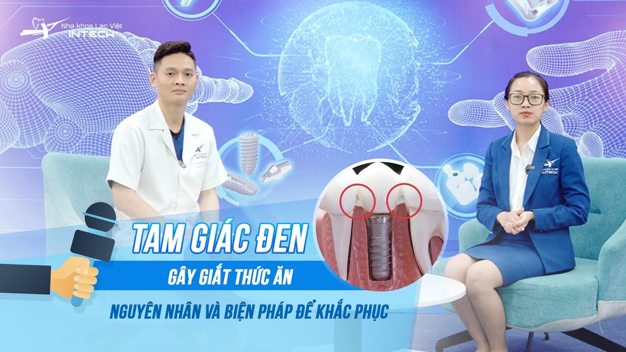 Outline Video Giắt Thức Ăn Sau Trồng Răng Implant - Nguyên Nhân Và Cách Khắc Phục