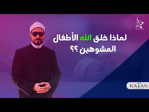 لماذا خلق الله الشر وإذا كان رحيما عادلا فكيف خلق الأطفال المشوهين عبدالله رشدي  