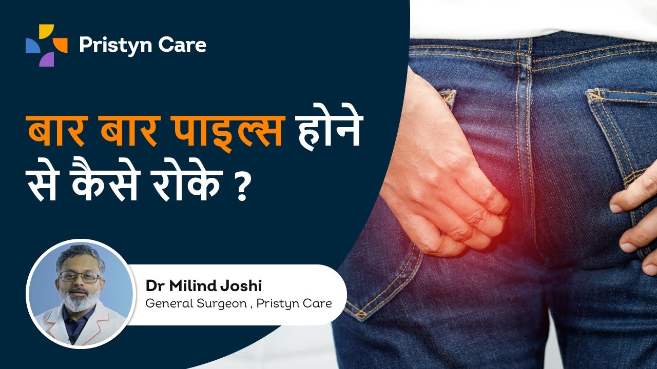 बार बार पाइल्स होने से कैसे रोके? | How To Prevent Piles Naturally In Hindi | 0806-5417-722