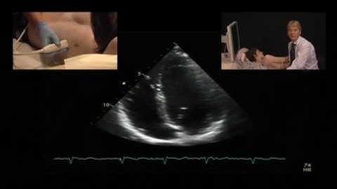 Optimized 4-Chamber View: the Right Ventricle