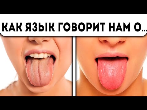 Ваше тело кричит о помощи! 6 проблем, о которых вам расскажет ваш язык! Про Здоровье