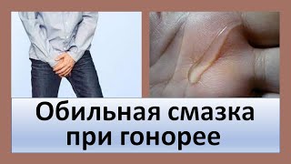 Обильная смазка при гонорее