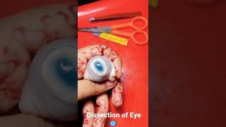 Dissection of Eye | parts of Real Eye 👁‍🗨