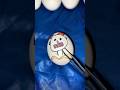 Egg man 🥚 vs pin 🧷