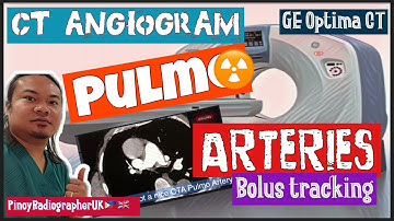 CT PULMONARY ANGIOGRAM|CTPA|Bolus Tracking|GE Optima 64 Slice CT