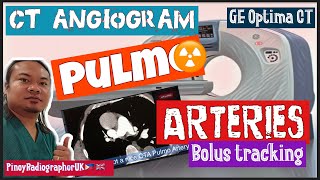 CT PULMONARY ANGIOGRAM|CTPA|Bolus Tracking|GE Optima 64 Slice CT screenshot 2