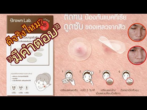 แผ่นแปะดูดสิว ดีจริงไหม? มีคำตอบ! แผ่นแปะดูดซับสิว คุยเรื่องสิวกับคนเป็นสิว