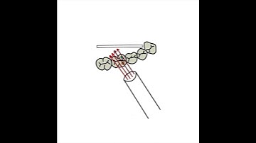 What is buccal object rule / SLOB rule?
