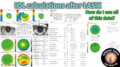 Methods for IOL calculations for Cataract Surgery after prior LASIK 