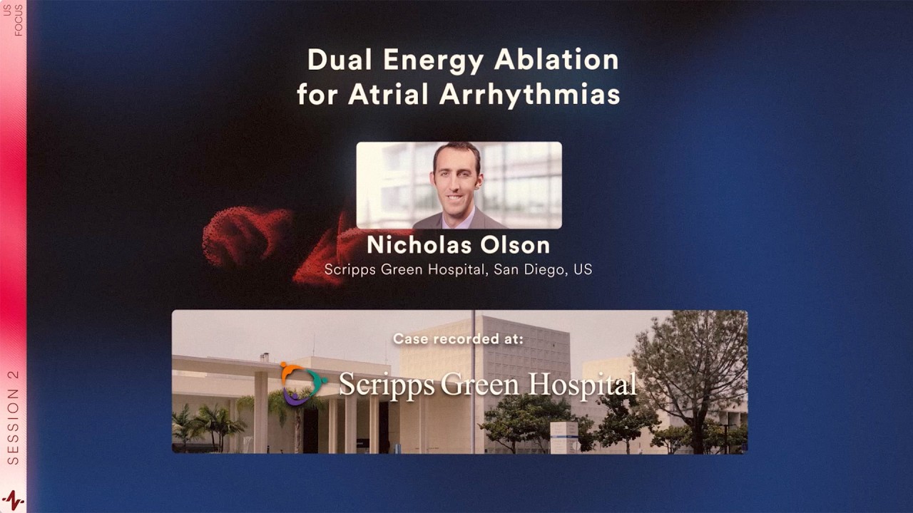 Dual Energy Ablation for Atrial Arrhythmias
