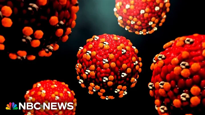 Canada loses Measles-free status after worst outbreak in 30 years