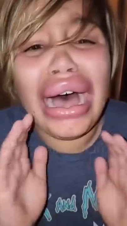 'My lips Exploded !?😱Lip Plumping hack💄 #viralshorts #youtubeshorts #makeuphacks