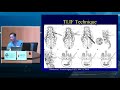 Posterior Lumbar Interbody Fusion (PLIF) and Transforaminal Lumbar Interbody Fusion (TLIF)