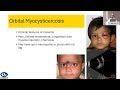 Aioc2024  gp36 topic  dr bhaduri anirban orbital infections and infestations