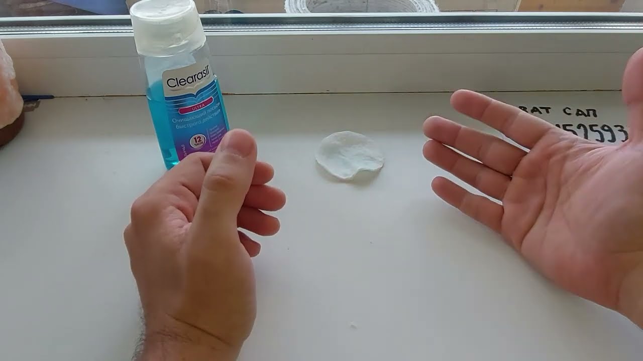 ВИТИЛИГО ОСТАНОВЛЕНО/Мои результаты