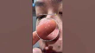 Testing the VIRAL Beplain Mung Bean Cleansing Oil on my bf 😱 #cleansingoil #blackheads #whiteheads