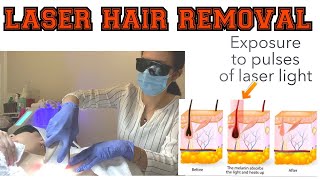 DIY Laser Hair Removal using i-Light Pro screenshot 1