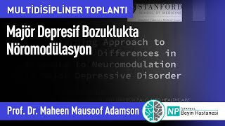 Multidisipliner Toplantı - Majör Depresif Bozuklukta Nöromodülasyon