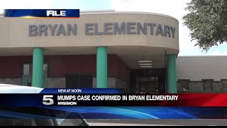 Case of Mumps Confirmed at Mission Elementary School