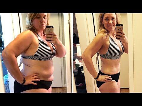 Apple Cider Vinegar Gummies For Weight Loss Applecidervinegar Pierdepeso