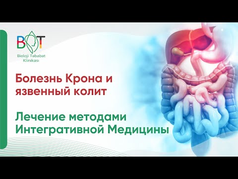 Видео: Как диагностировать и лечить болезнь Крона: 9 шагов (с иллюстрациями)