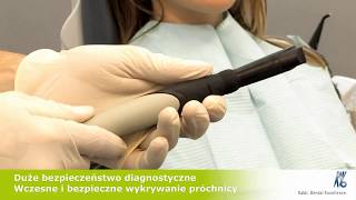 Диагнокам - визуальная диагностика зубов прямо в кресле.(, 2018-04-27T02:00:37.000Z)