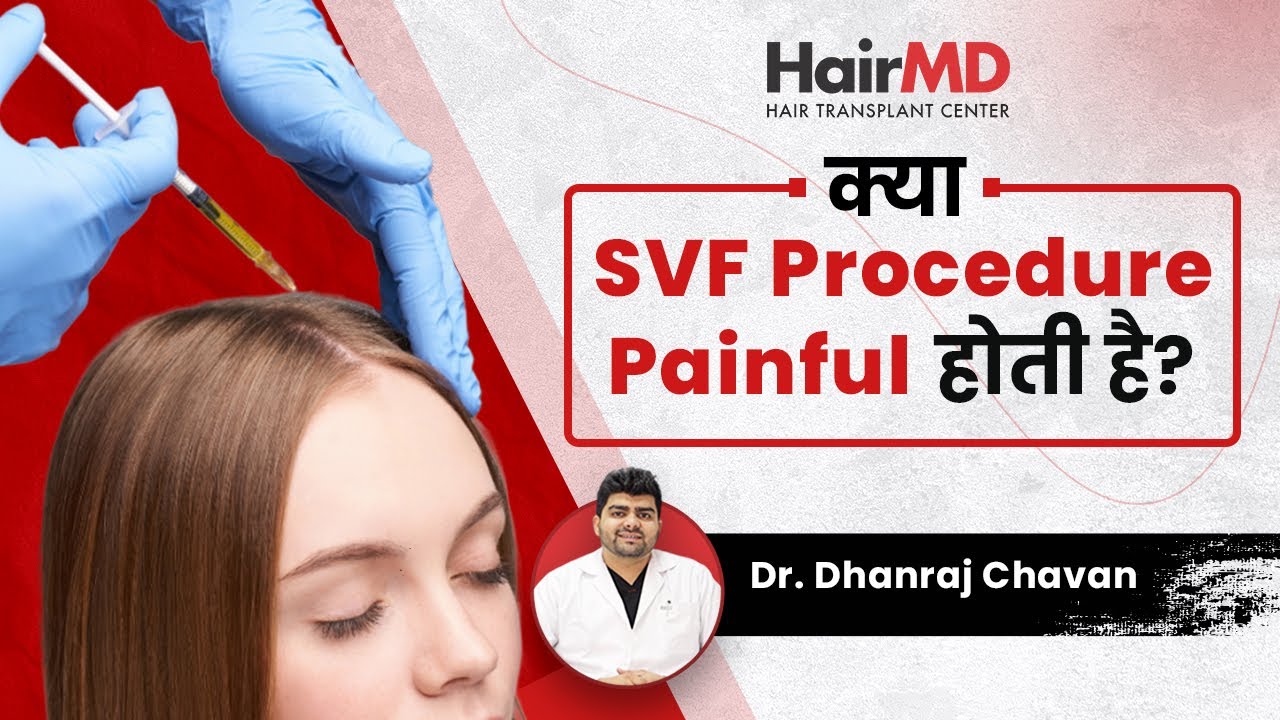 क्या  SVF Procedure Painful होती है? | Pain Levels in SVF Treatment | HairMD, Pune