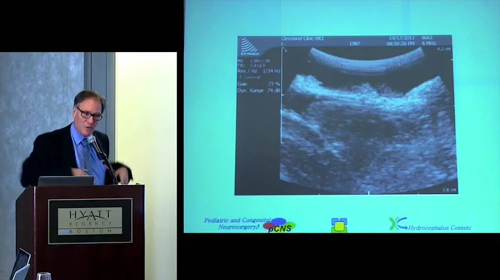 CSF Colloquium: "Chiari Malformation in the Context of CSF Disorders"