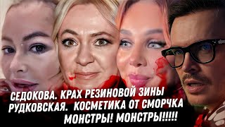 Download Lagu Уголовное дело Седоковой. Цирк Рудковской. Утяшева эскорт для Винер. Дибровы Товстики! Волочкова ОР! MP3 Download Lagu Уголовное дело Седоковой. Цирк Рудковской. Утяшева эскорт для Винер. Дибровы Товстики! Волочкова ОР! MP3