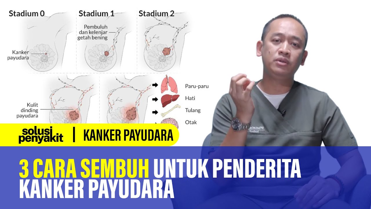 Kanker Payudara Gejala, Penyebab dan Penanganannya Kata Dokter 158