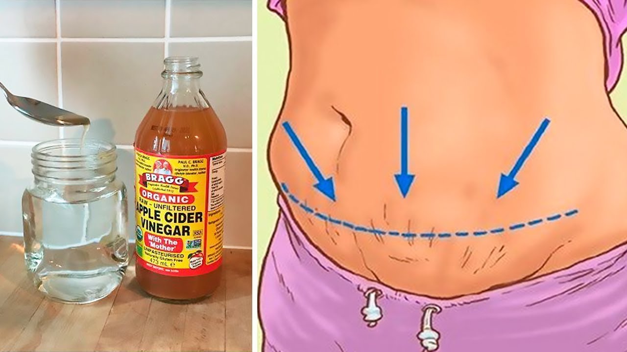 Shocking Side Effects Of Apple Cider Vinegar YouTube