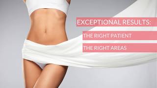 Liposuction In Virginia Beach: Is It Right For You?