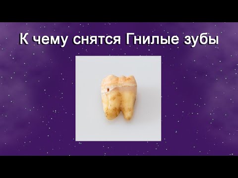 К чему снятся Гнилые зубы – толкование сна по Соннику