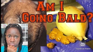 Powerful Ginger, Onion and black Jamaican castor oil Hair growth recipes for hair loss.