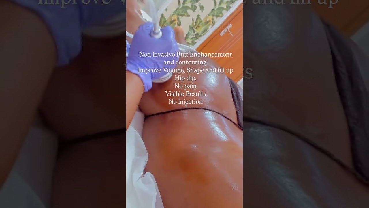 Body contouring at DNS Aesthetics