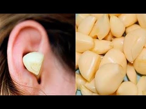 Video: Der Mann Ging Monatelang Mit Knoblauch Im Ohr Und Glaubte An Seine Kraft - Alternative Ansicht