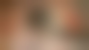 Combined Phacoemulsification with Trabeculectomy with Mitomycin C for open Angle Galucoma