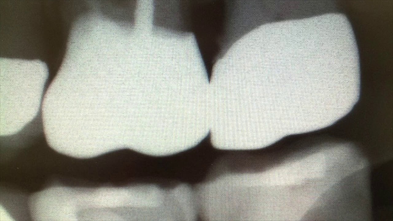 Pam's Magic Tractor-Time to Kill